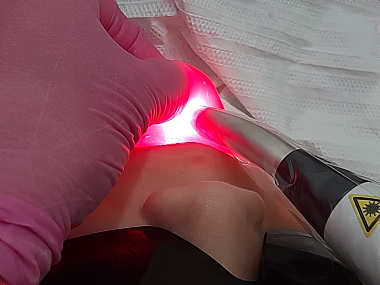 LASER NA ODONTOPEDIATRIA